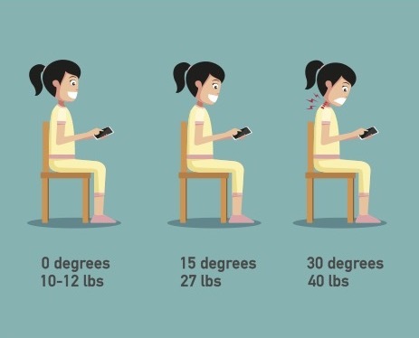 Correcting Nerd Neck: A Guide to Improving Forward Head Posture