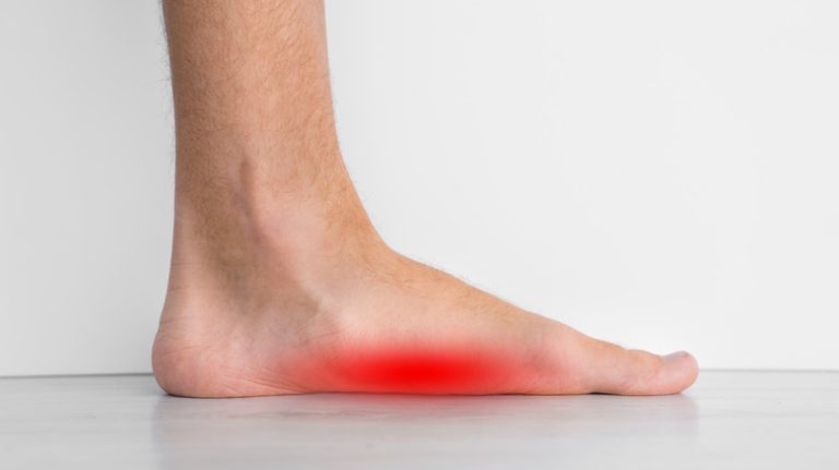 Is Yoga an Effective Remedy for Flat Feet?